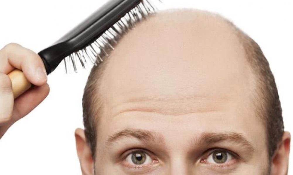 Αυτή είναι η ουσία που προκαλεί έντονη τριχόπτωση